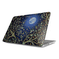 Macbook Case